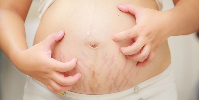 Itchy-Skin-During-Pregnancy